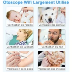 Otoscope Wifi-3.9mm HD USB Endoscope Sans Fil Kit De Caméra De Nettoyage Et D'inspection Des Oreilles Avec 6 Lumières LED, Adapté Pour IPhone, Android, Tablette 9 Otoscope Wifi-3.9mm HD USB Endoscope Sans Fil Kit De Caméra De Nettoyage Et D'inspection Des Oreilles Avec 6 Lumières LED, Adapté Pour IPhone, Android, Tablette -Promos Brico Forte Boutique 88109555 5